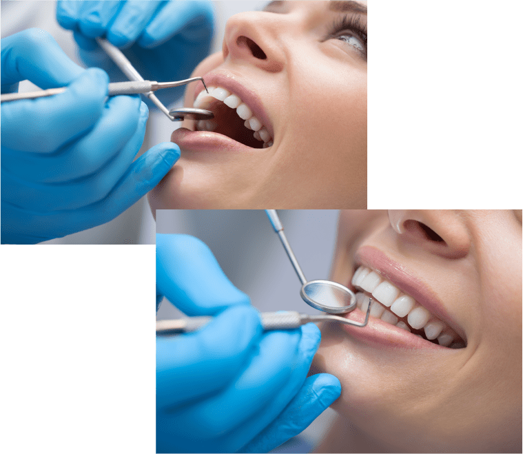 tratamientos dentales cartagena - clinica dental del valle